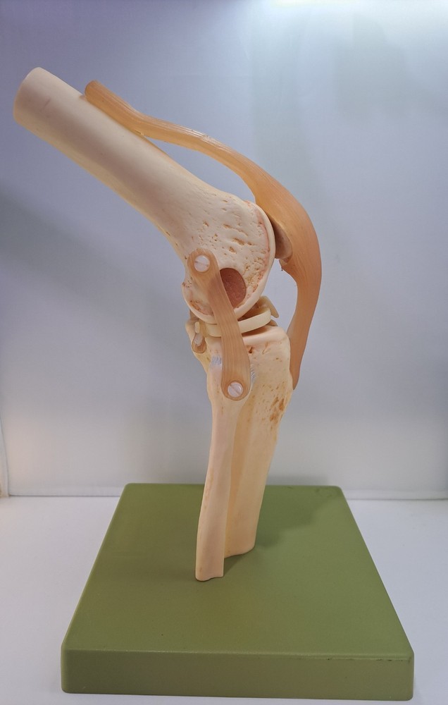 Vintage 1995 Somso Anatomical Model Functional Knee Joint Model BIN86