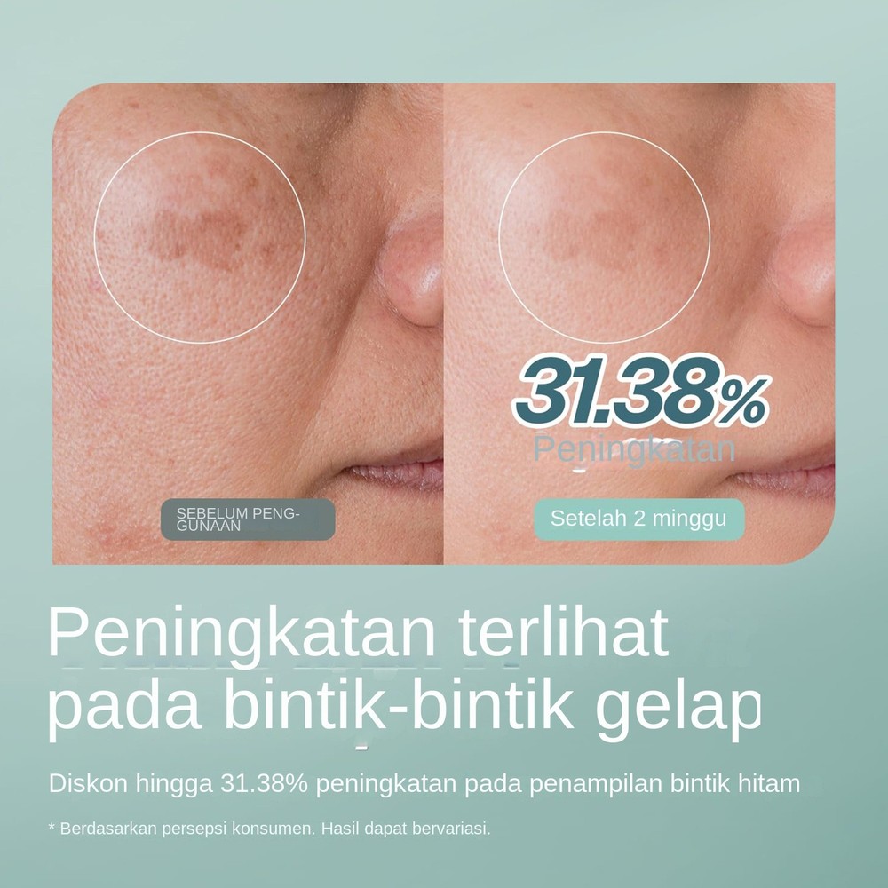 CHARDE Melapeel Cream Mask 50ml