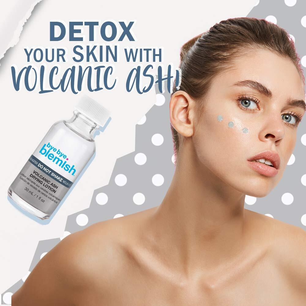 Bye Bye Blemish Drying Lotion Volcanic Ash Anti-Acne Drying Solution 1 Fl. Oz.