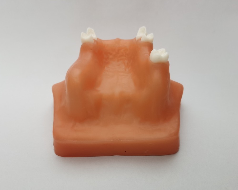 Dental Maxillary Sinus Lift Model Typodont Practice Model Show
