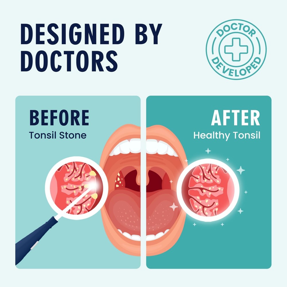 Dr. Frederick’s Original Easy Tonsil Stone Remover Kit - 8 Piece Set, White