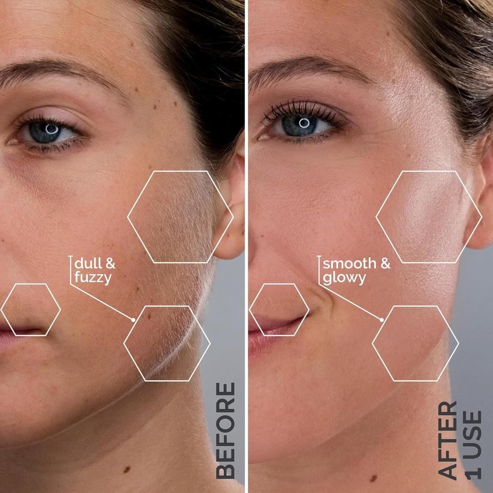 Michael Todd Beauty - Sonicsmooth SONIC Technology Dermaplaning Tool