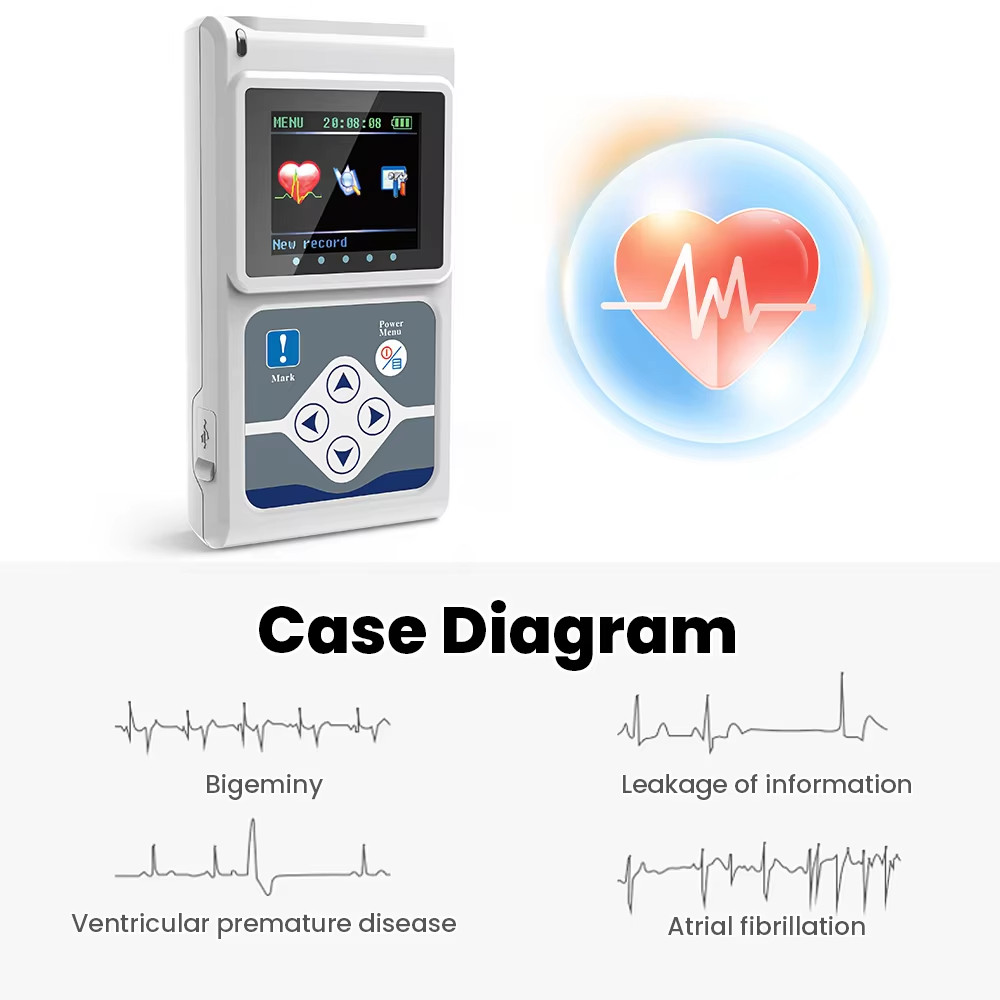 Contec TLC9803 Dynamic ECG Systems Digital Analyzer Recorder System ECG Holter