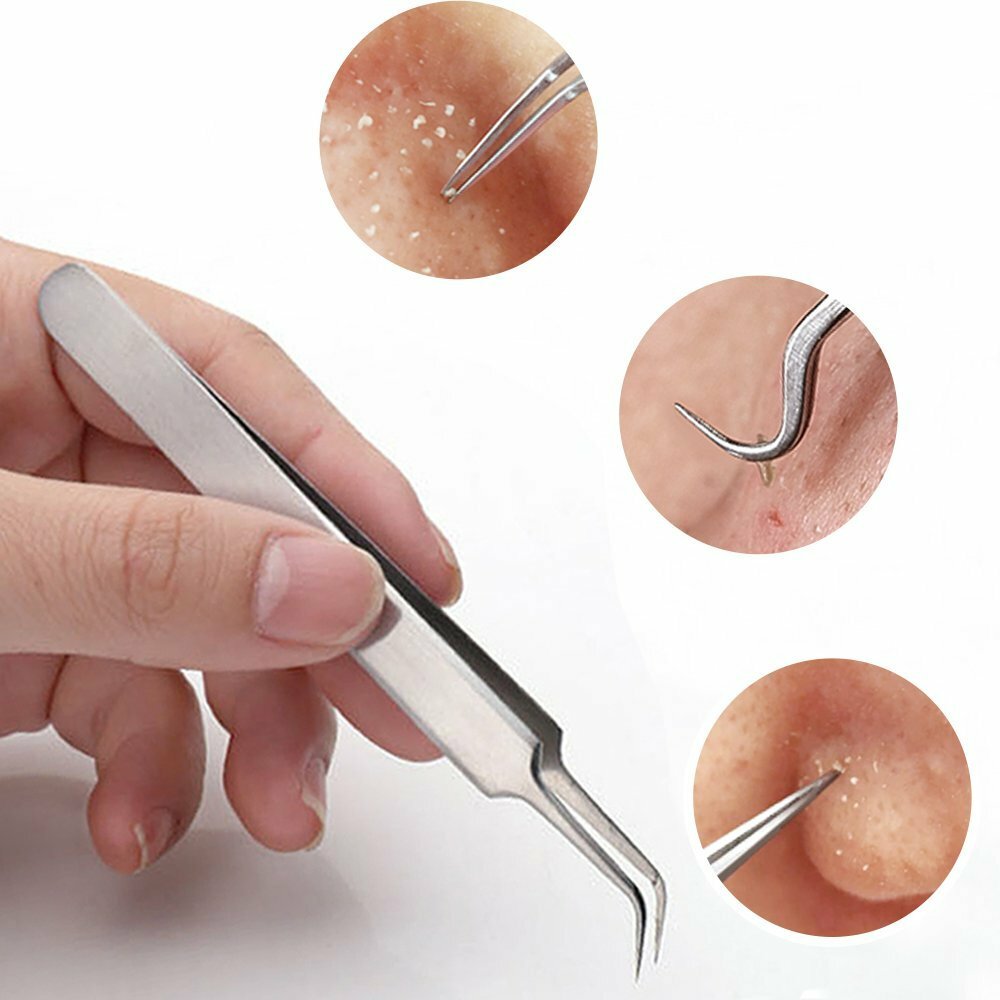 9 PCS Stainless Steel Extraction tools Blackhead Remove Pimple Popper Tool Kit