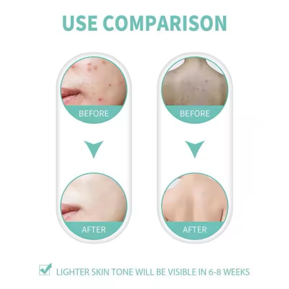 Razor Bumps Solution, After Shave for Ingrowns and Burns, Dark Spot Corrector