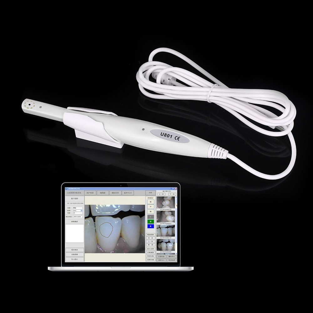 SOLARCAM 1080P USB Intraoral Camera - White