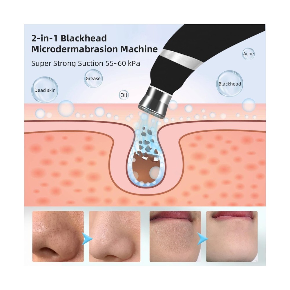 IeBilif Diamond Microdermabrasion Machine, 3 Modes Diamond Microdermabrasion ...