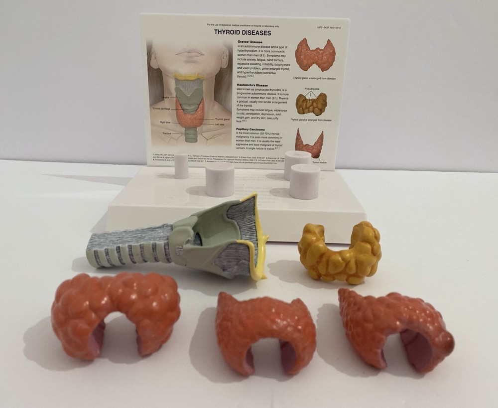 Healthy and Pathological Human Anatomical Thyroid Model - Pathology Anatomy