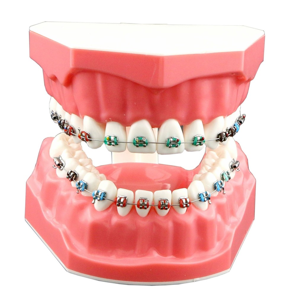 US Dental Typodont Teeth Model with Orthodontic Brackets Brushing