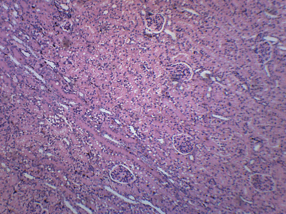 Kidney Section, Human - Prepared Slide - 75x25mm - Eisco Labs