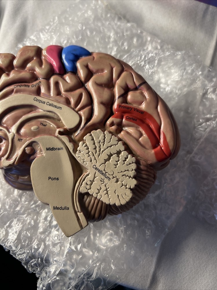 3-D Maxalt Merck An Inside Look At Migraine Teaching Tool