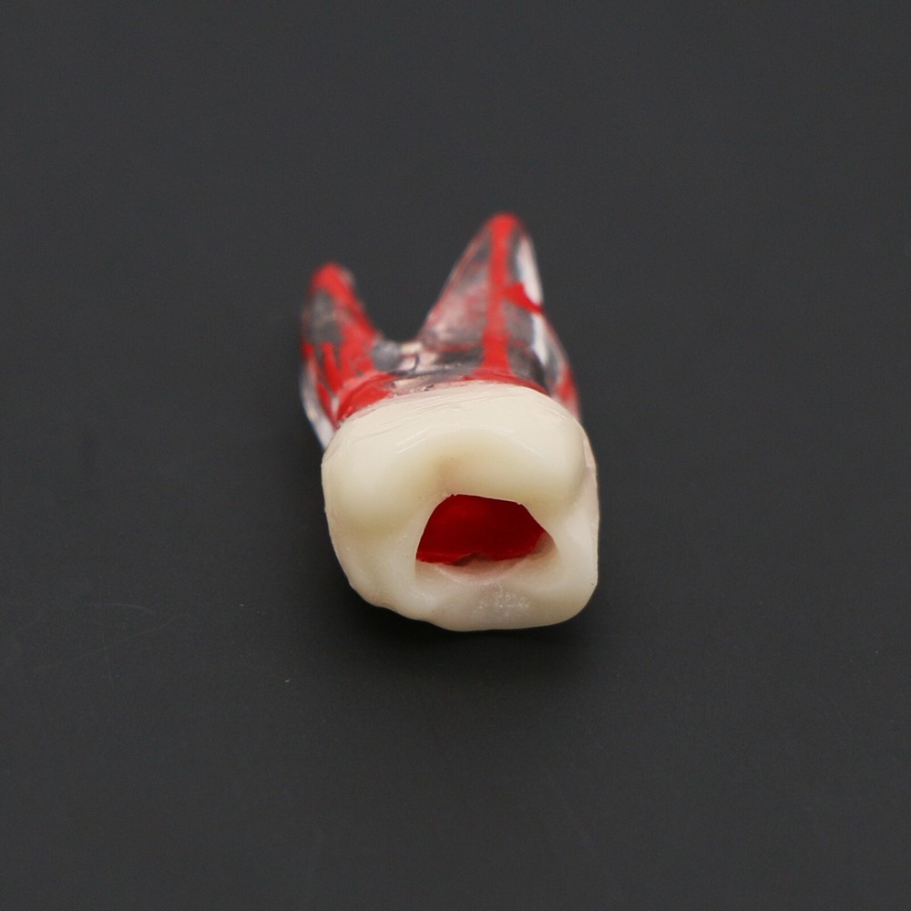 Dental Typodont Endodontic Practice Pulp-Opened RCT Root Canal Teeth Model M8008
