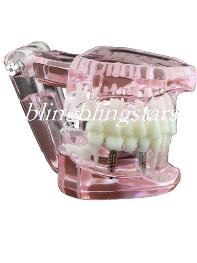 Dental Implants Training pathologies & techniques Pathological Disease Teeth