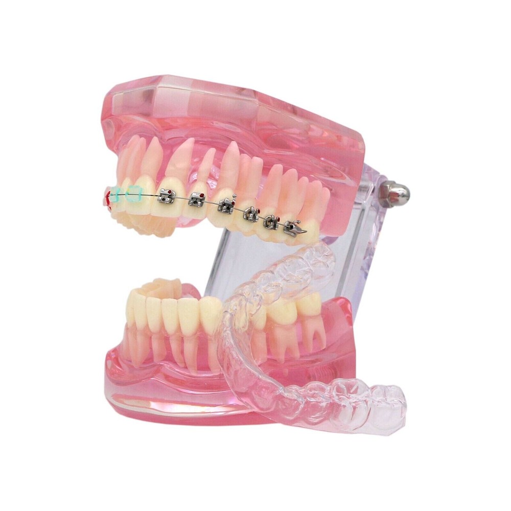 Dental Typodont Model Self-ligating Metal Bracket Ceramic Transparent Retainer