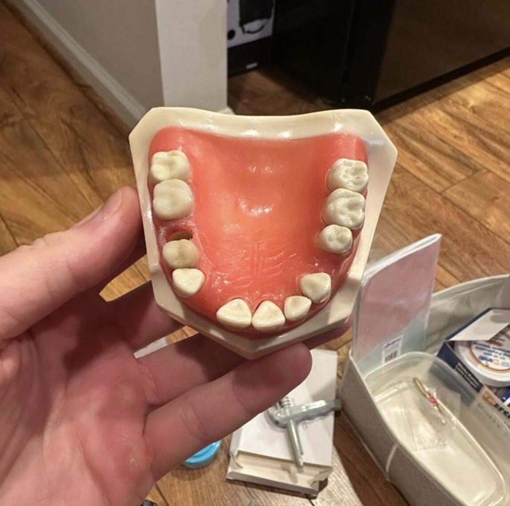 Maxillary Dental Typodont With Gaps