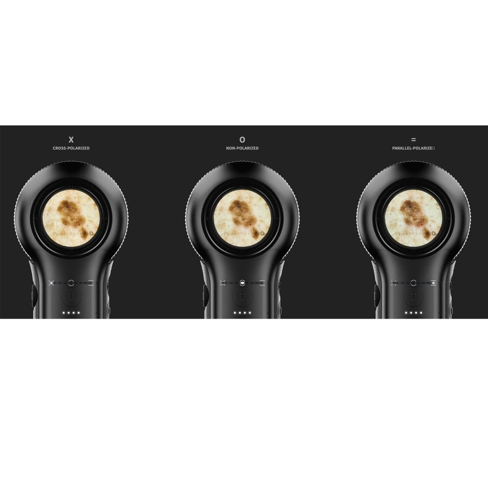 DermLite® DL5™ Portable Dermatoscope w/10 x Magnification, Variable Polarization