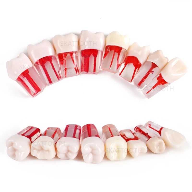 20Pcs Dental Endo Root Canal Teeth Model Practice RCT Pulp Study Typodont Model