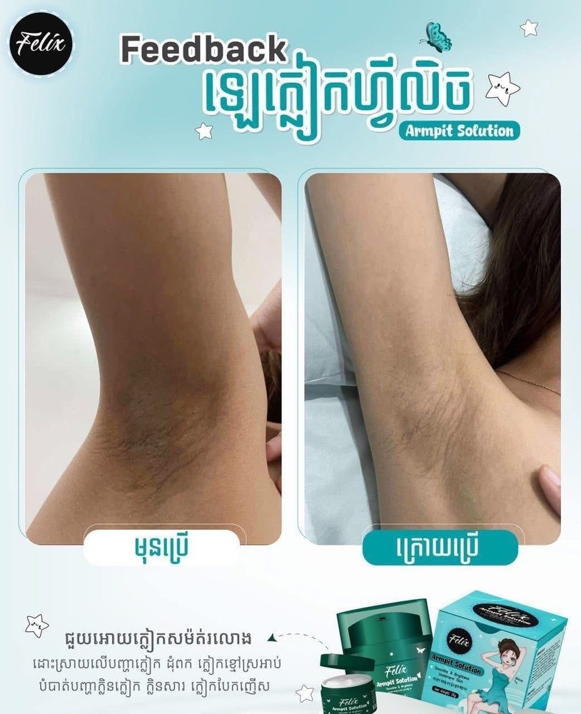 Felix Armpit Solution Cream លេលាបក្លៀកសរ ( 18g )