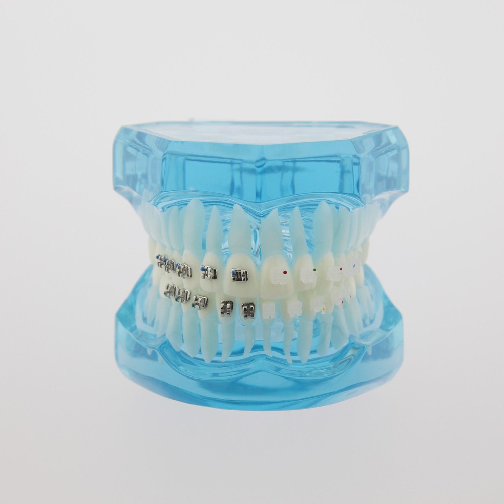 Dental Teach Study Typodont Teeth Model Half Metal Bracket Half Ceramic Bracket