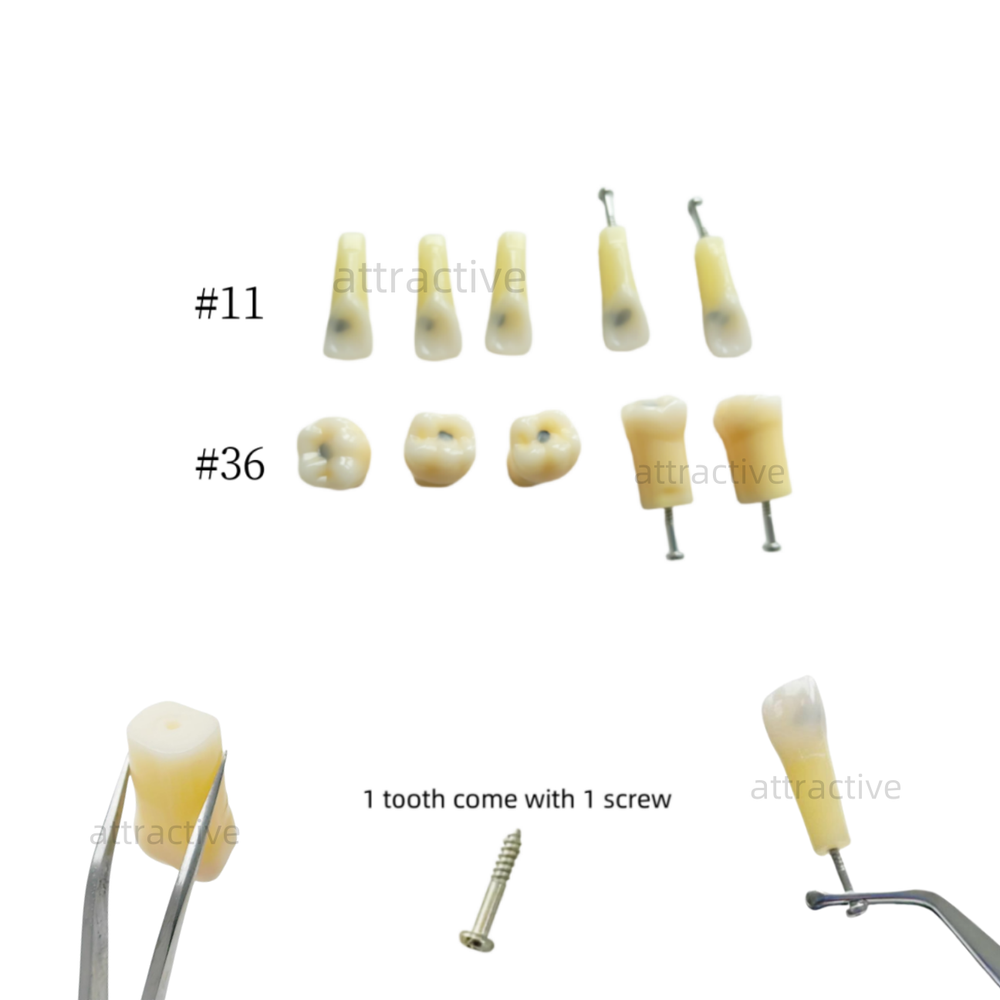 Dental Molar/Front Vitro Teeth Decay Caries Tooth Model Dentist Student Practise