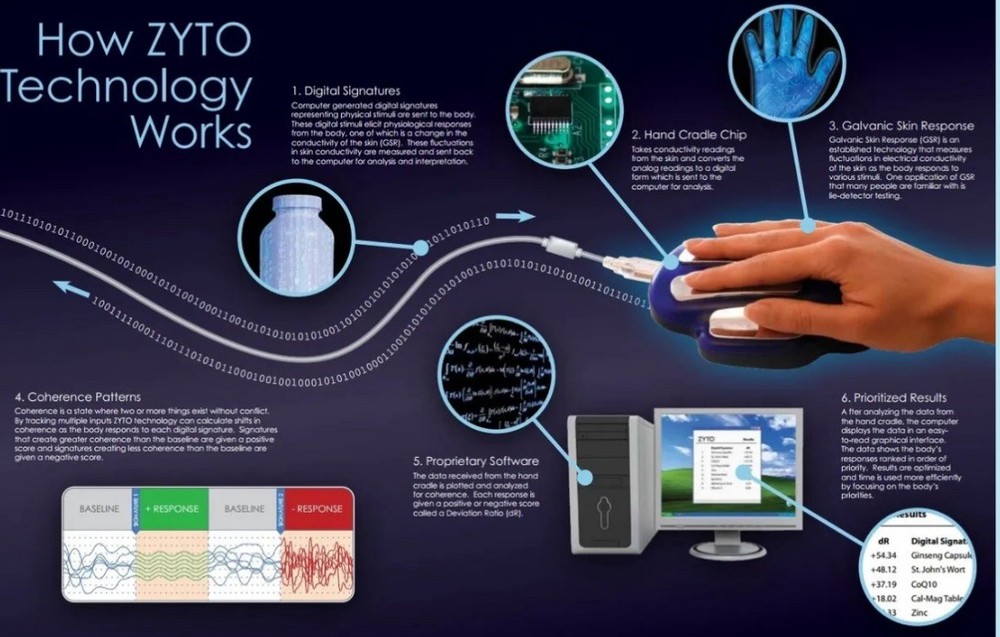 Zyto Elite 5.0 Software License With Two Hand Cradles