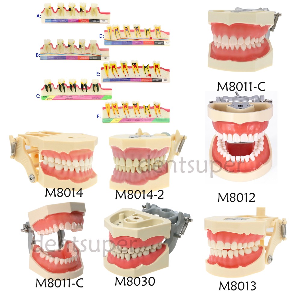 Dental Typodont Model Pathological Implant Ortho Perio Demo Practice Teeth Model