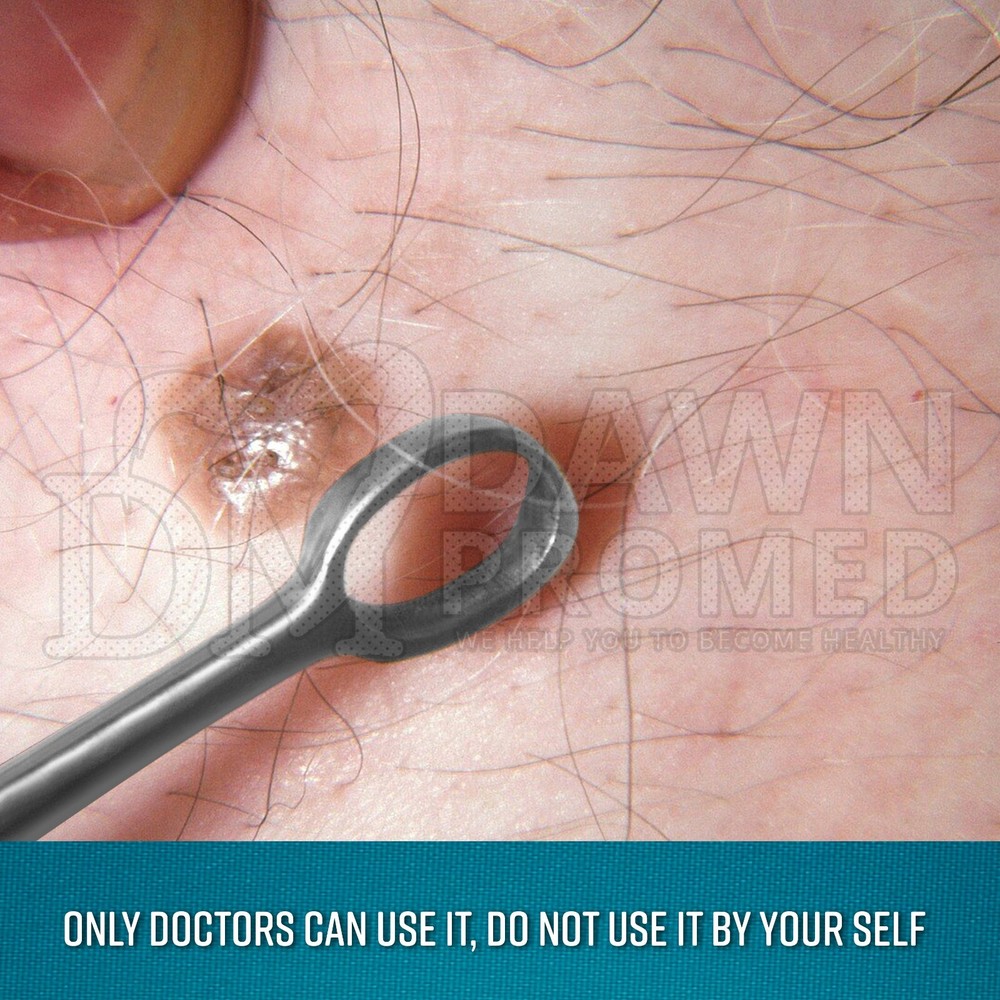 Fox Dermal Curettes Dermatology 1mm - 6mm ENT Instruments German Grade