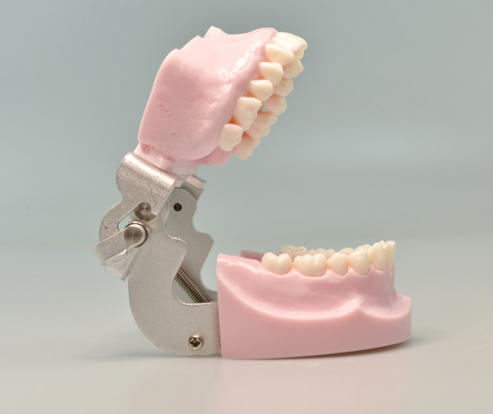 Dental Typodont Orthodontic Model Teeth Anchorage Implant Training Practice