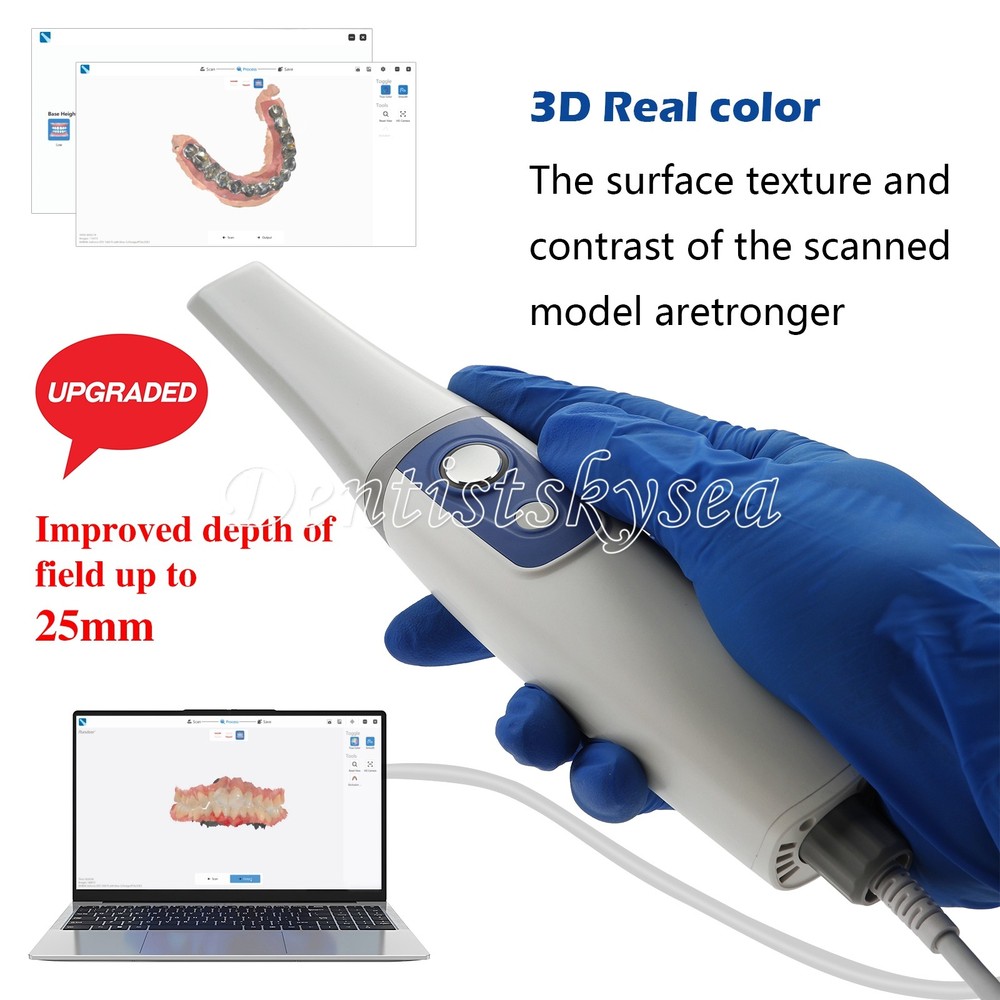 Intraoral Scanner Digital Dentistry
