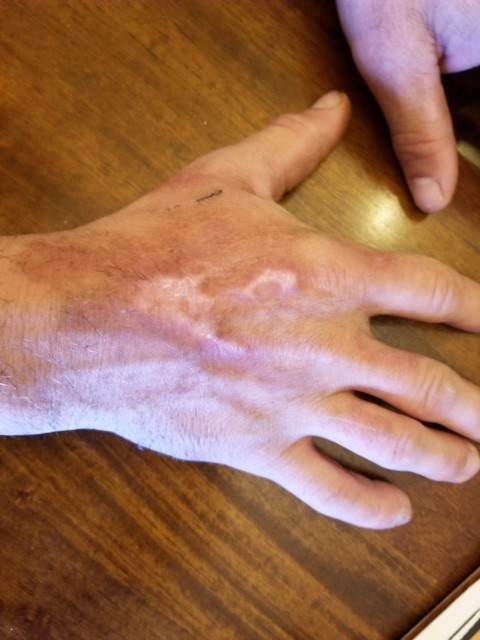 MAGIC V Wound Healing Cream 8oz.