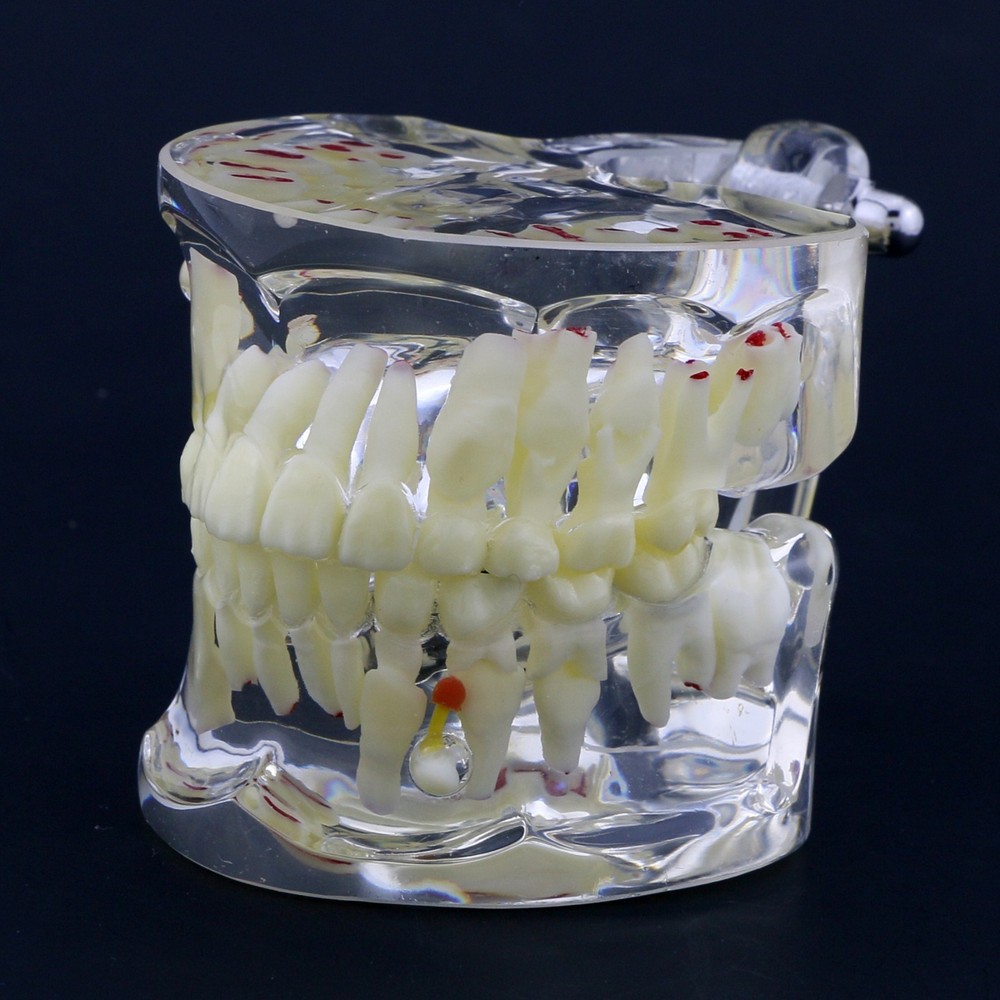 Dental Children Pediatric Pathology Demonstration Study Tooth Teeth Model 4002