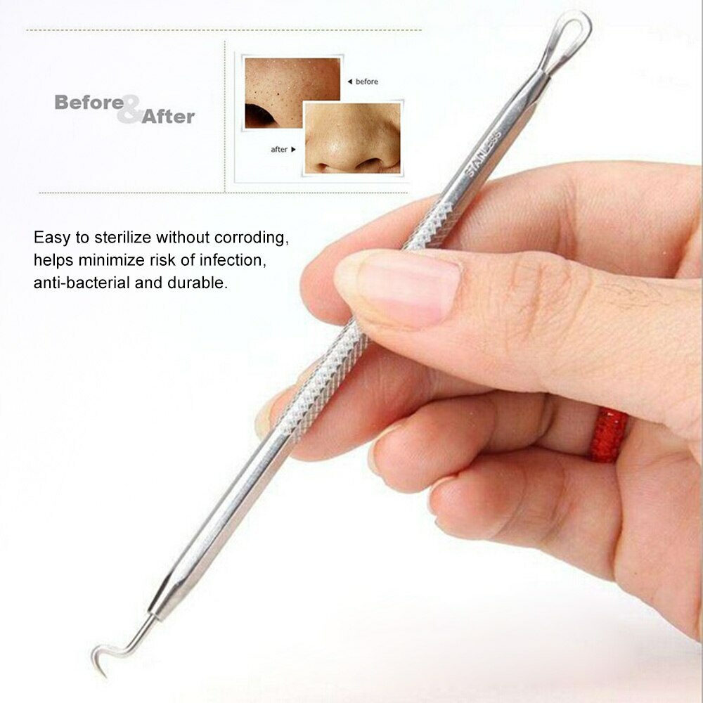 Blackhead/Whitehead Cleaner Acne Remover Comedone Extractor Tool kit SC-1109