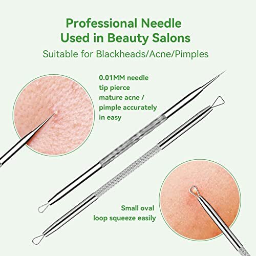 Pimple Popper Tool Kit,Blackhead Remover Tool 5 Pcs Blackhead Extractor Tool