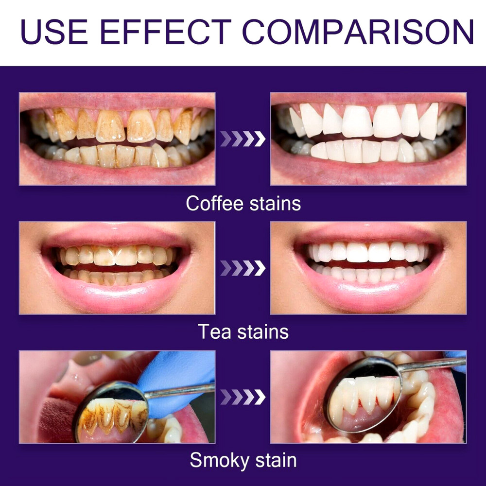 V34 Purple Color Corrector Teeth Toothpaste Most Effective Whitening