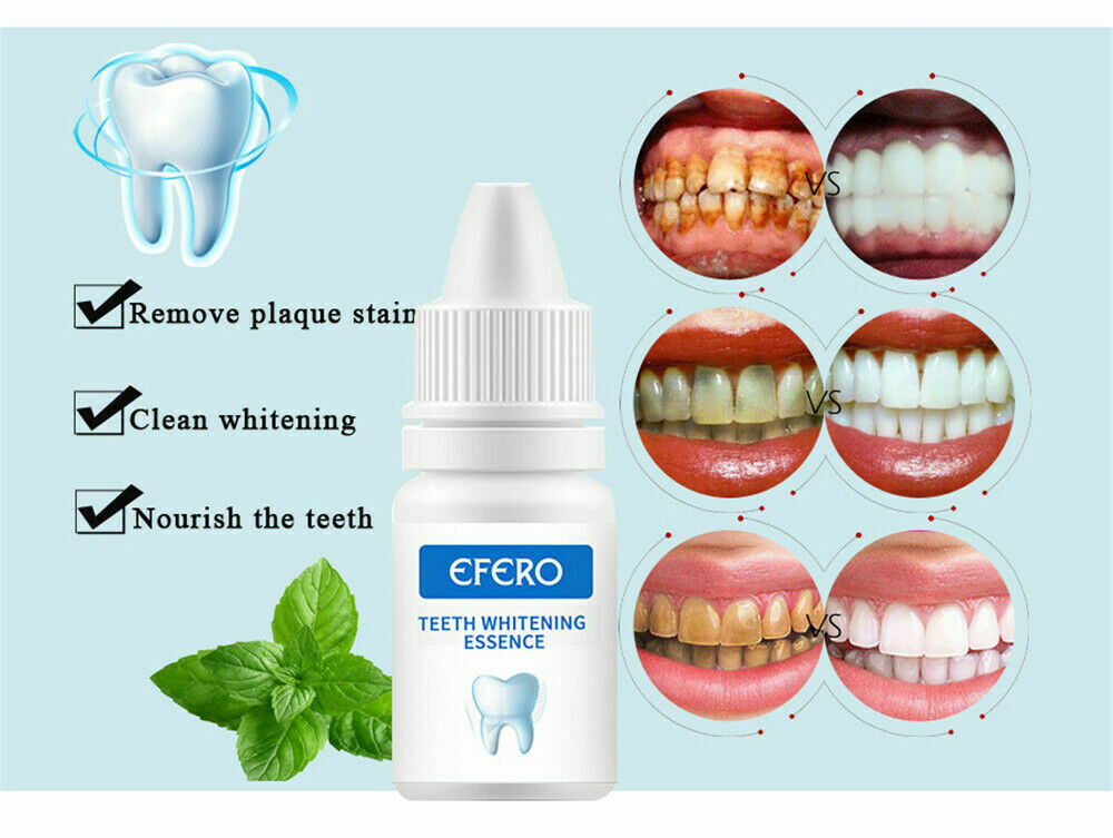 3PCS Whitening Teeth Bleach Gel Instant Whiter Advanced Bleaching White Stained