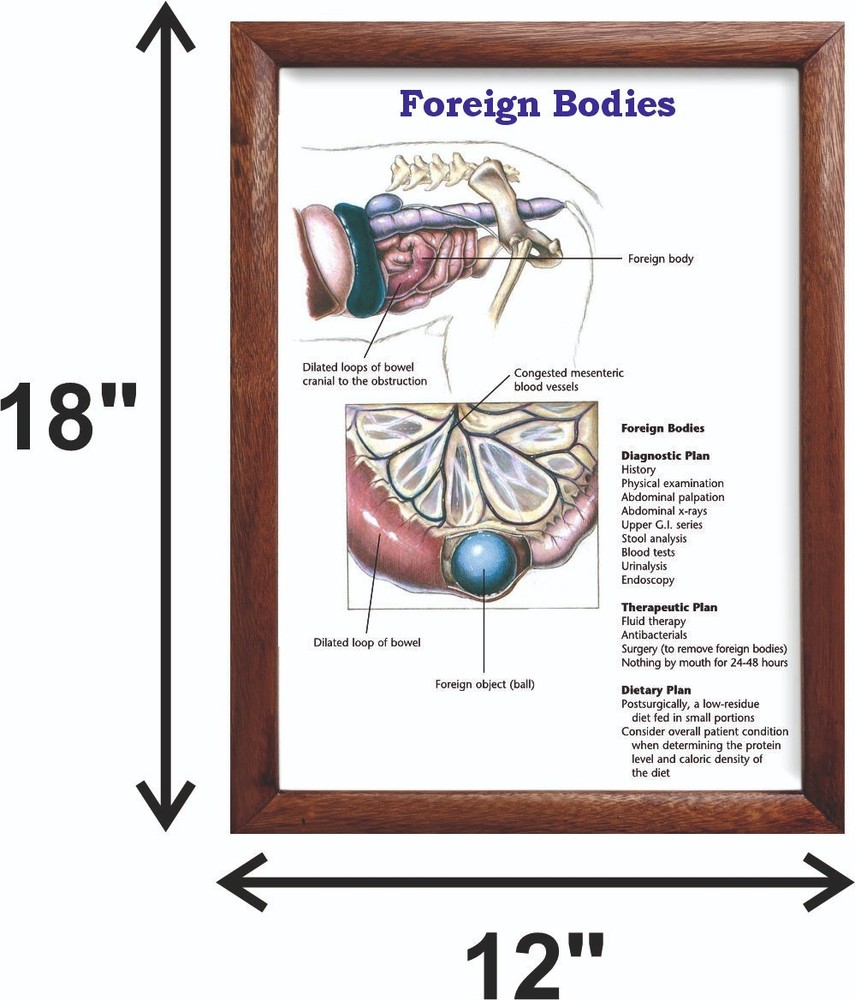 Foreign Bodies Chart 12x18 inches