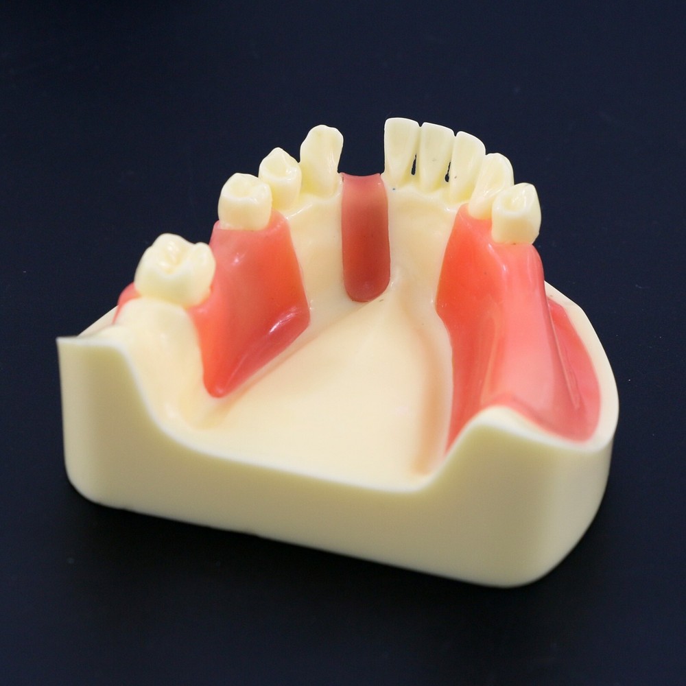 Dental Lower Jaw Implant Drilling Practice Teeth Model Gingiva M2004 Removable