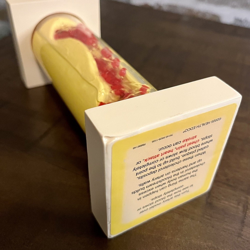 Health EDCO Occluded Artery Model Great Patient Visual Cholesterol Education