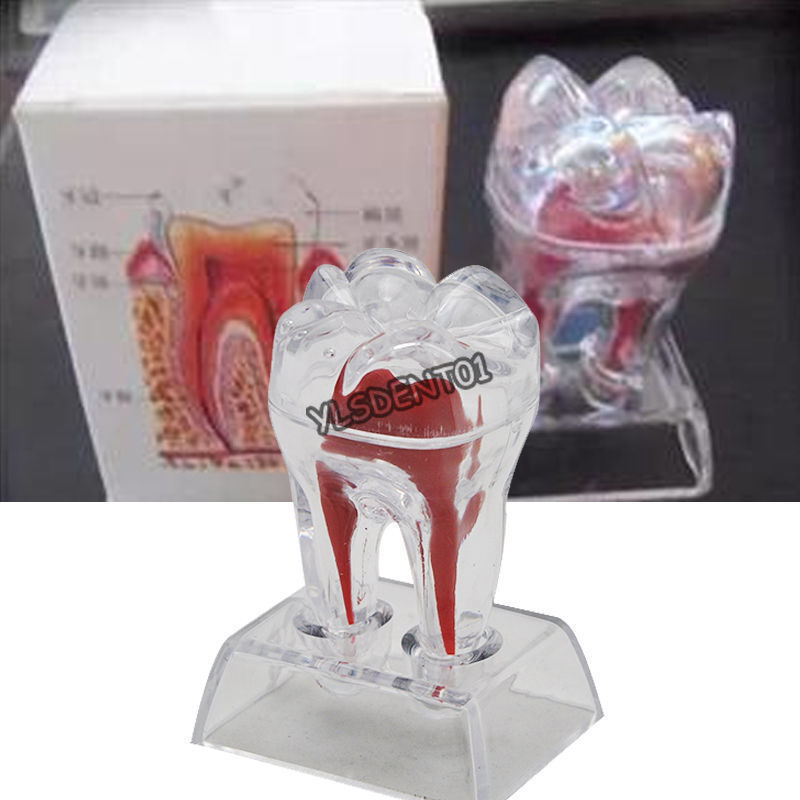Tooth Molar Model Dentist Dental Crystal Base Hard Plastic Teeth Separable
