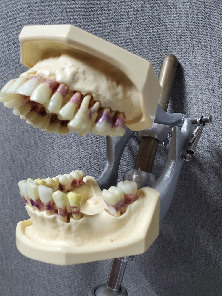Mounted Dental Typodont Model And Mounting Pole