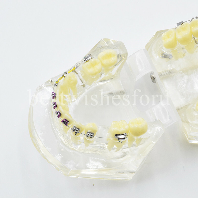 Dental Malocclusion Treatment Teeth Model Study Typodont Elastic chain 3005-2