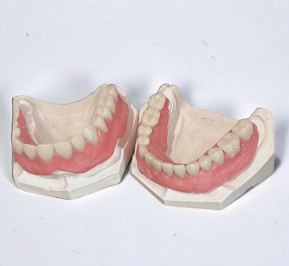 Acrylic False Teeth Only | DIY Denture Making Repair Upper Lower No Base