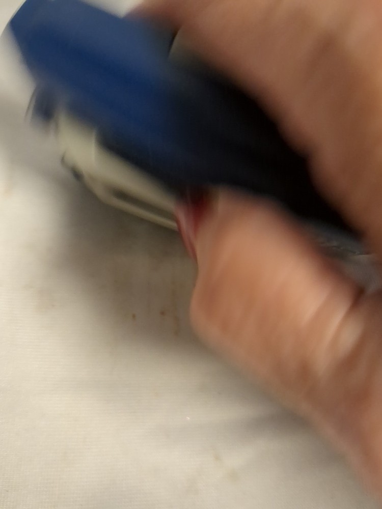 TENS AA (Transcutaneous Electrical Nerve Stimulation)