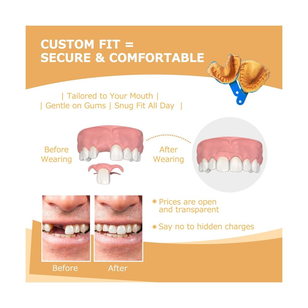 Partial Dentures - Dentures for Missing Teeth & Gaps - Lightweight & Unbreaka...