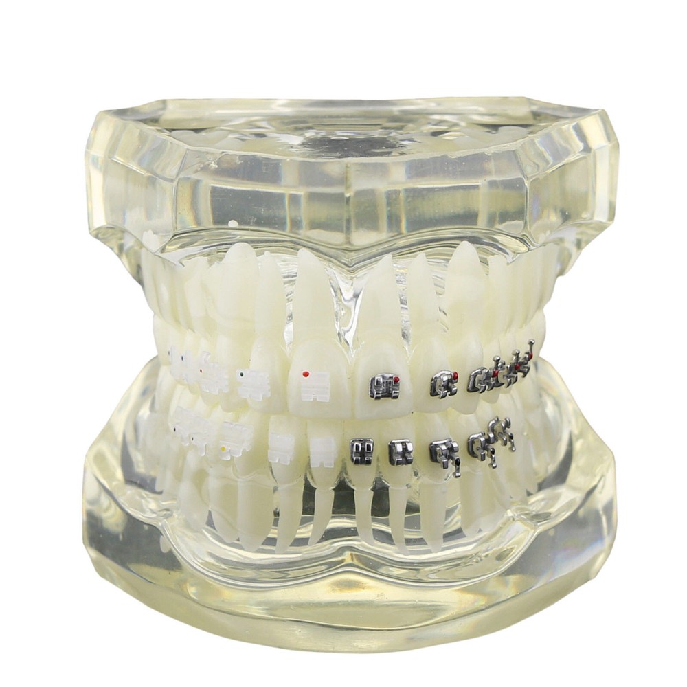 Dental Orthodontic Lab Clinic Ceramic and Metal Bracket Study Typodont Model