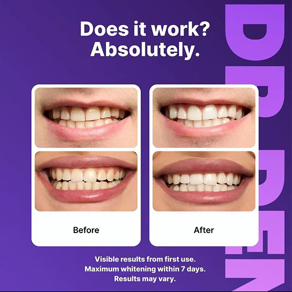 Purple Teeth Whitening Strips PAP Formula Peroxide‑Free 28pcs Sensitive