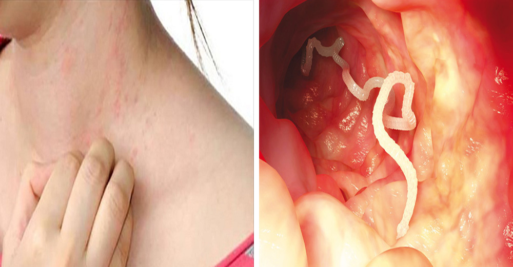 Powerful Colon Cleanse - ANTI-PARASITE COMPLEX - Cranberry 1B