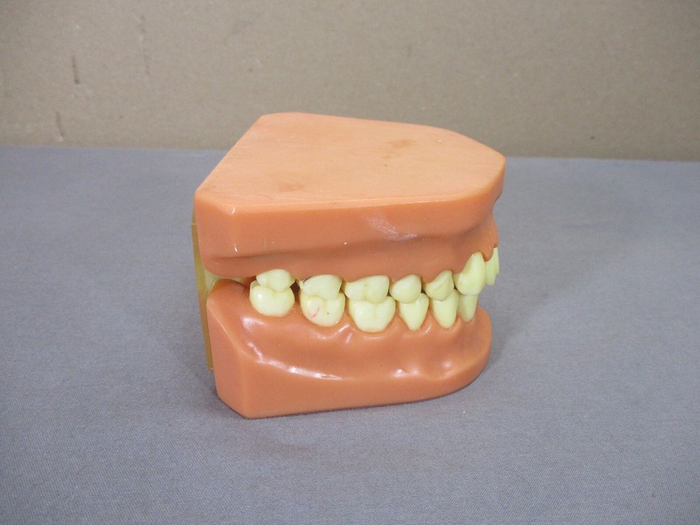Dentist Typodont Dentoform Dental Model Teeth Overbite Tooth Display Hinged Set