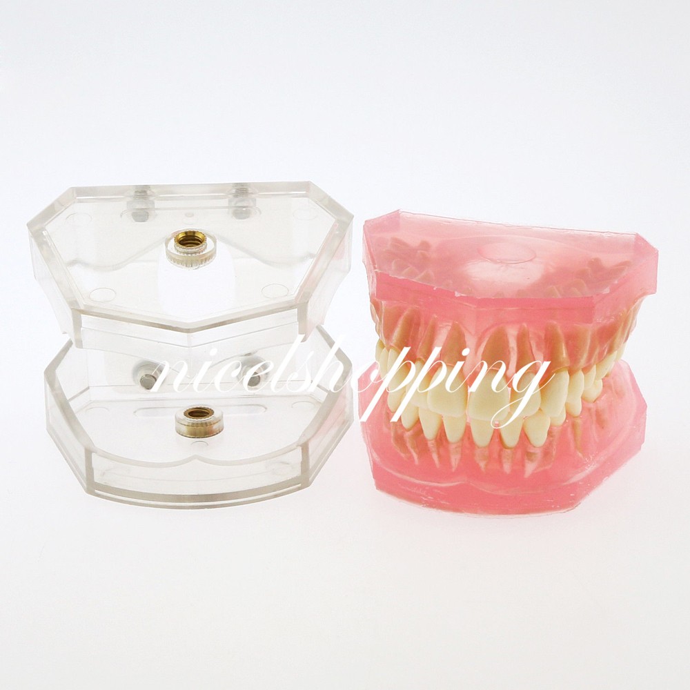 Dental Orthodontic Teeth Model 4004# with 28 Removeable Teeth Standard Plastic