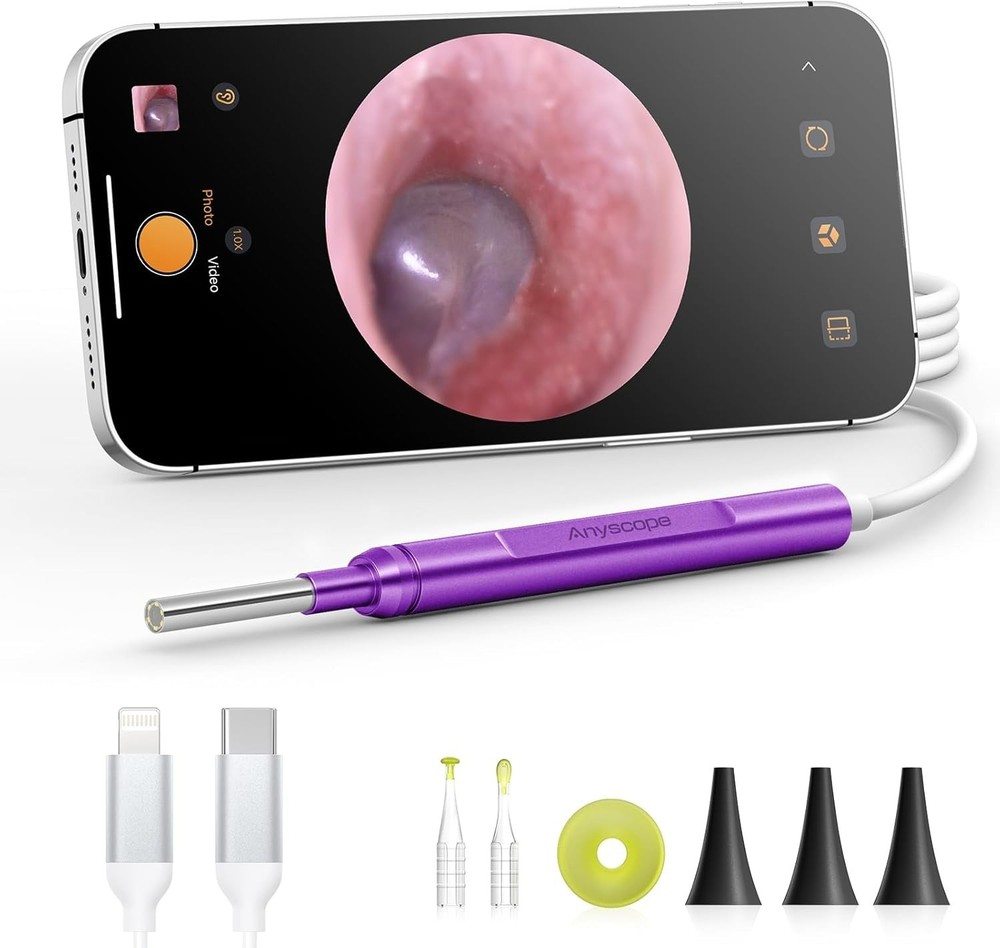 Digital Otoscope Compatible with iPhone and Android Devices Video Ear Scope